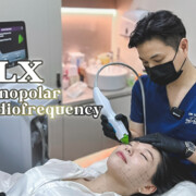 thermage skin  tightening cost